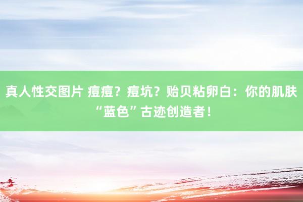 真人性交图片 痘痘？痘坑？贻贝粘卵白：你的肌肤“蓝色”古迹创造者！